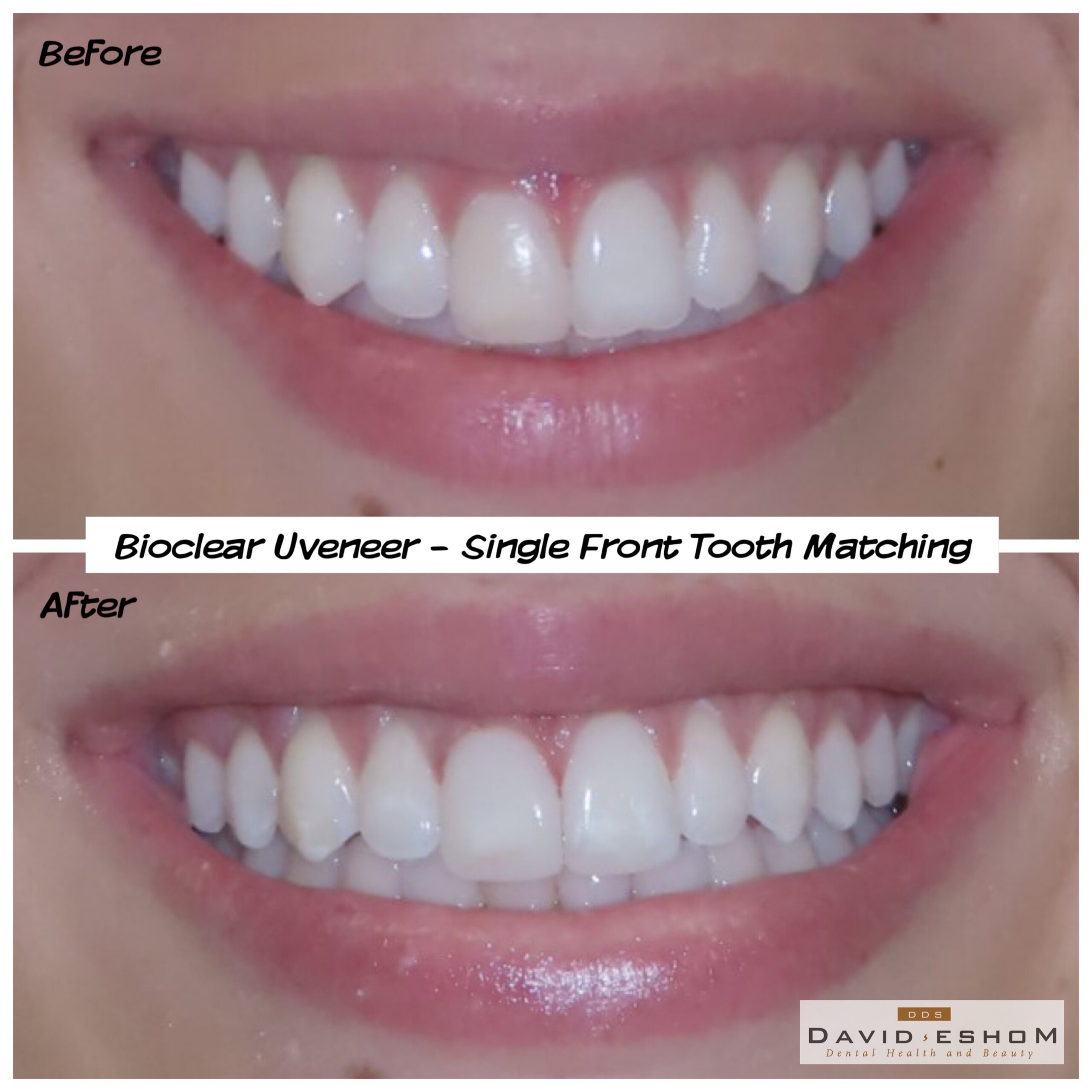 Bioclear