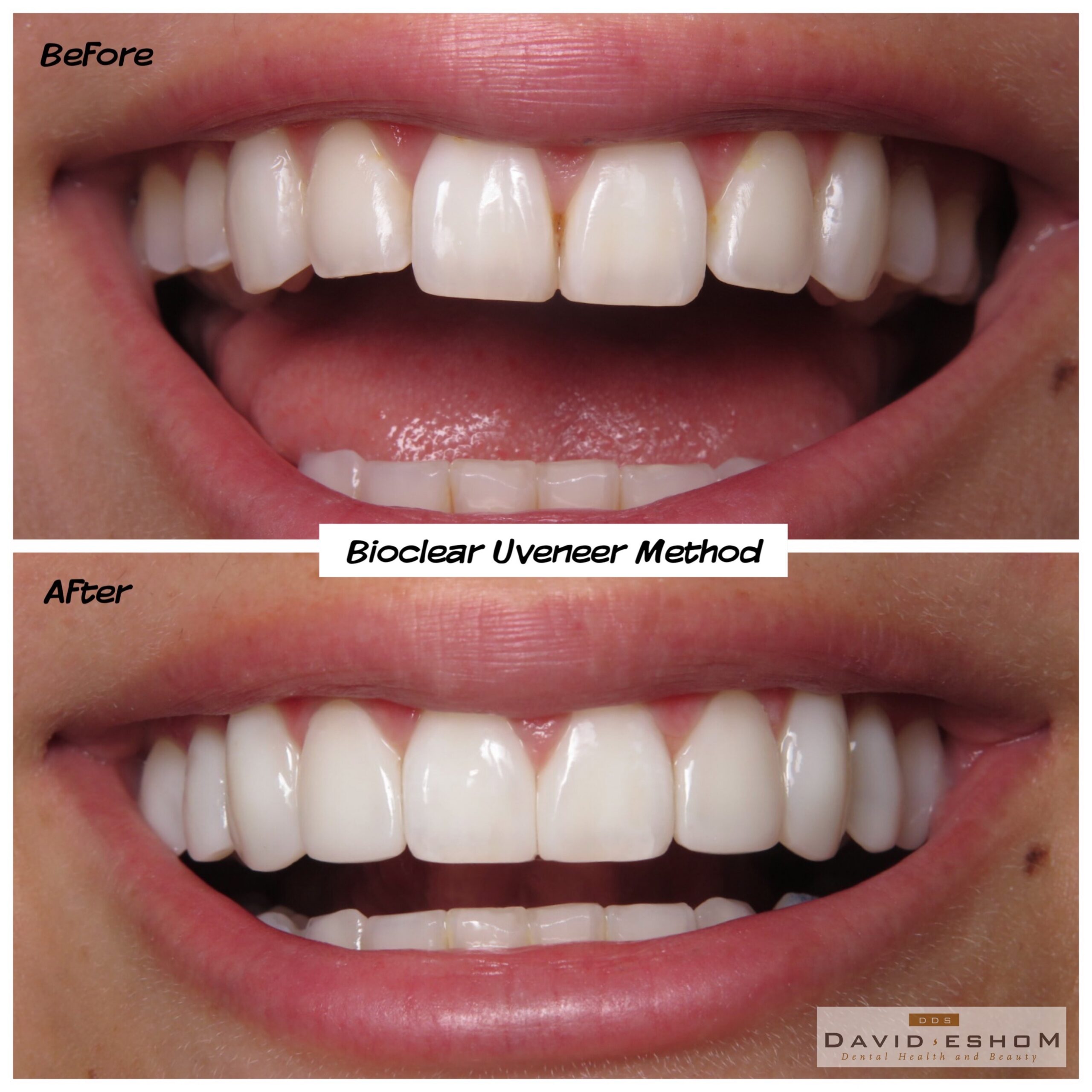 Bioclear