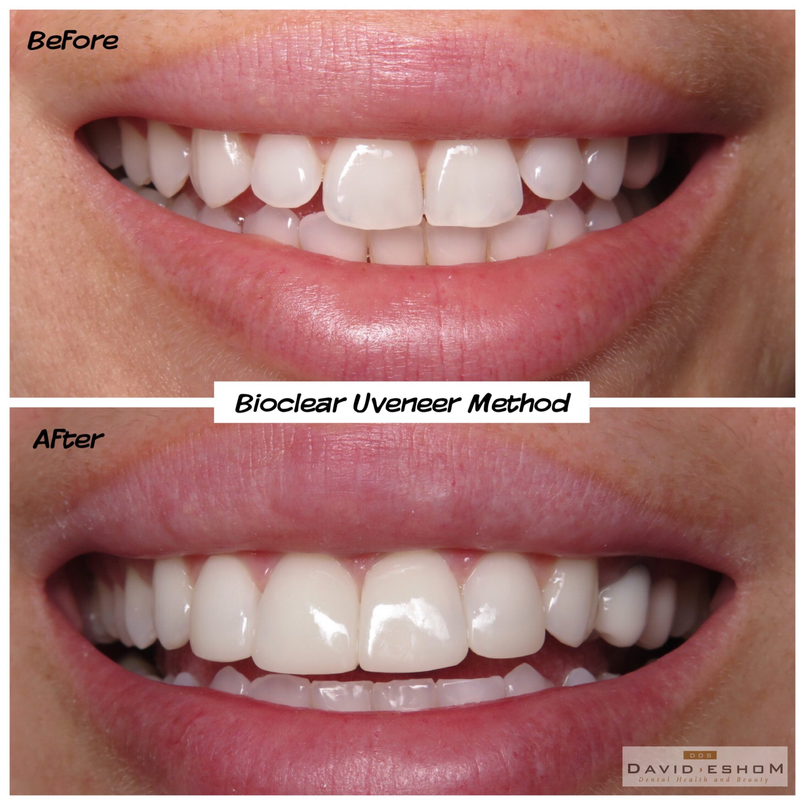 Bioclear