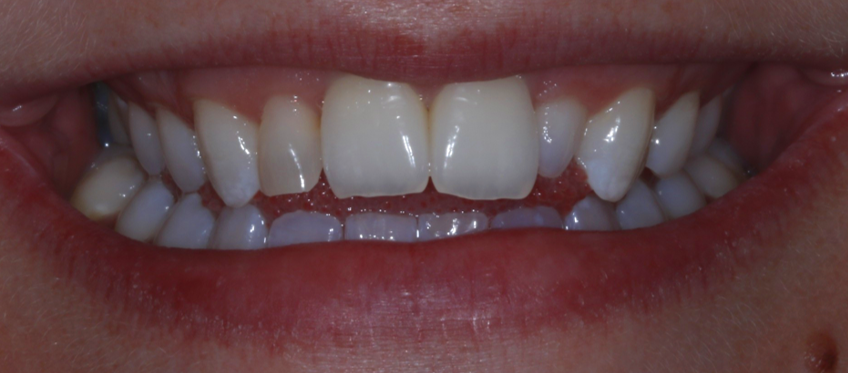 Bioclear