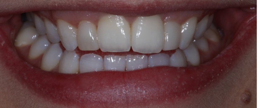 Bioclear