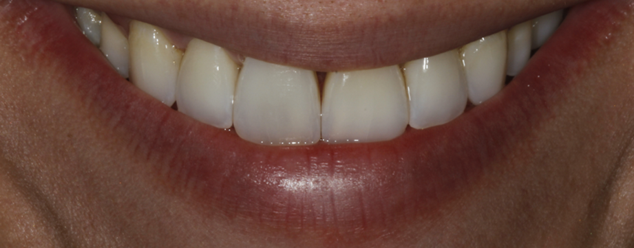 Bioclear