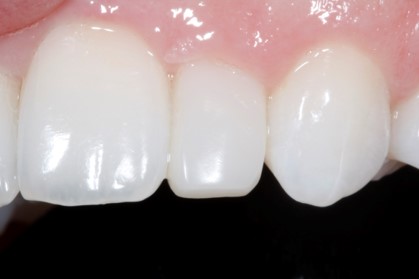 Bioclear