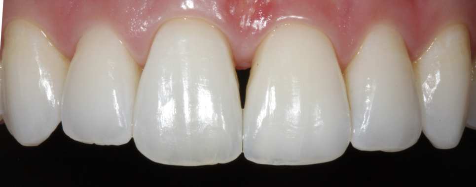 Bioclear