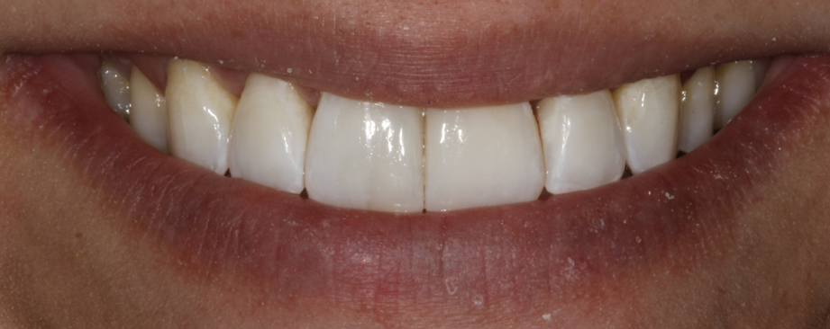 Bioclear