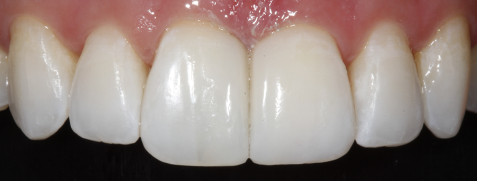 Bioclear
