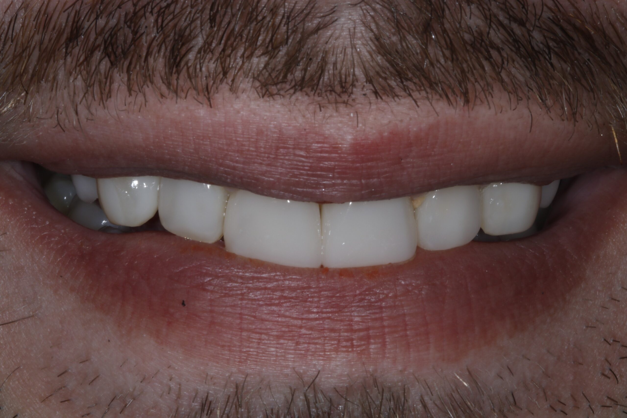 Bioclear