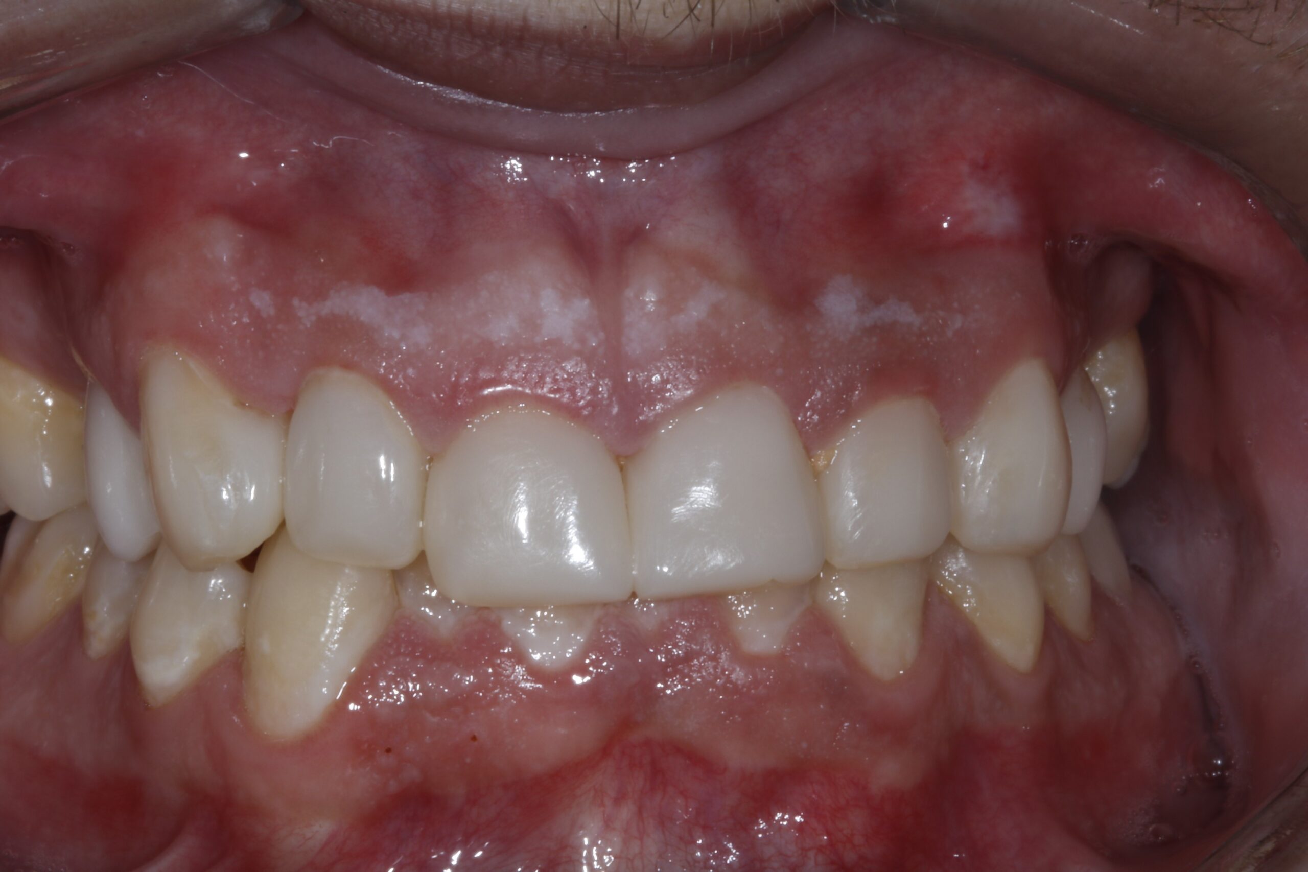 Bioclear