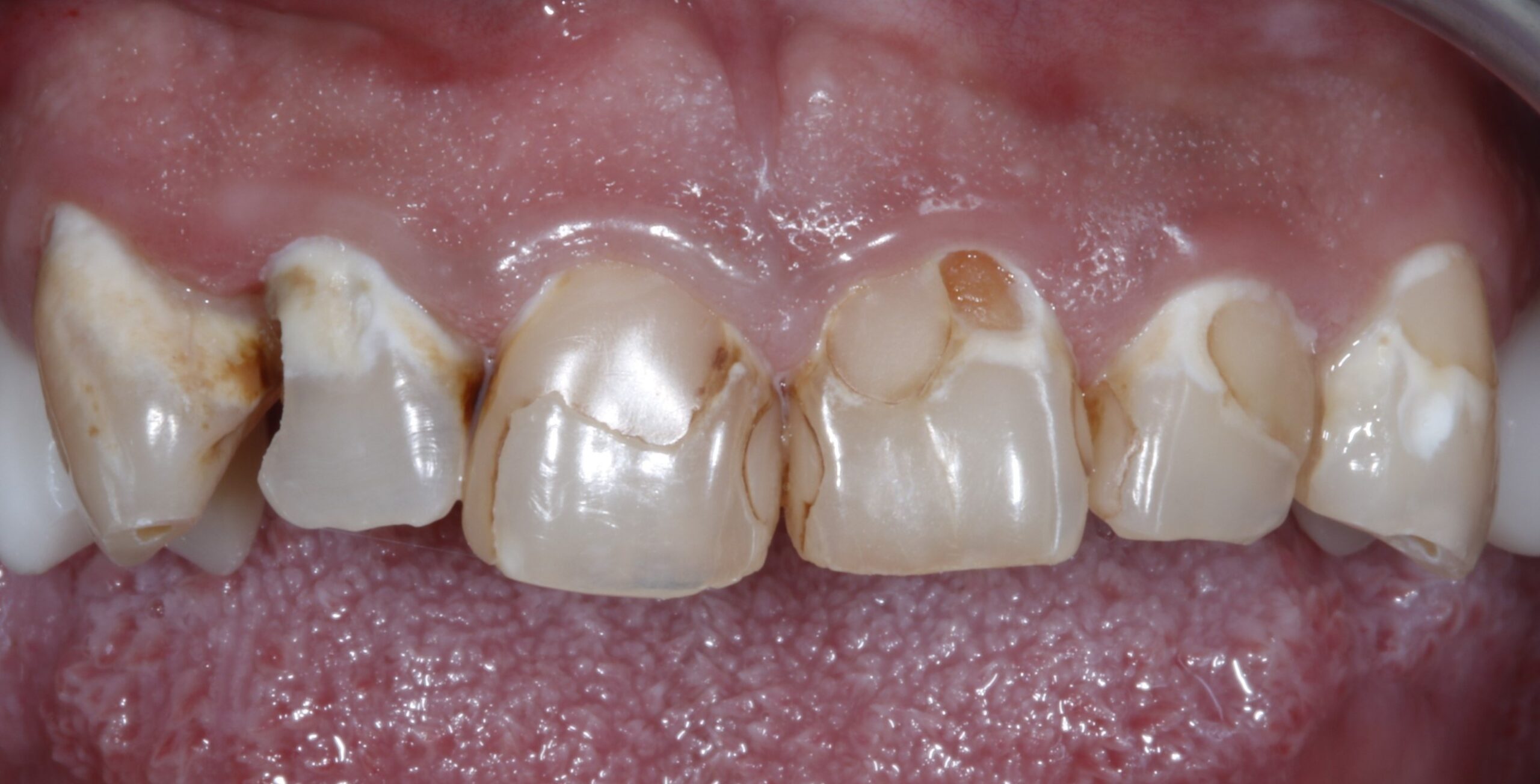 Bioclear