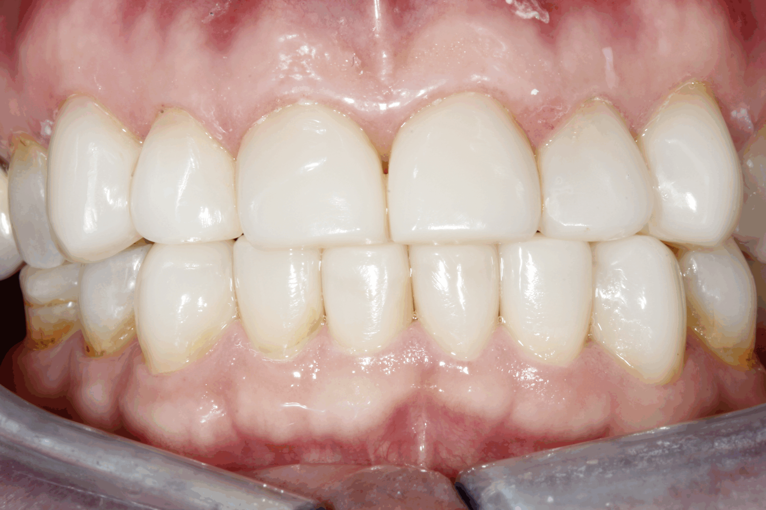 Bioclear