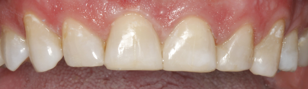 Bioclear