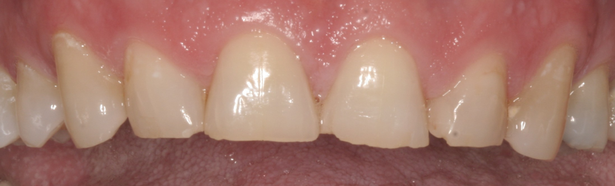 Bioclear