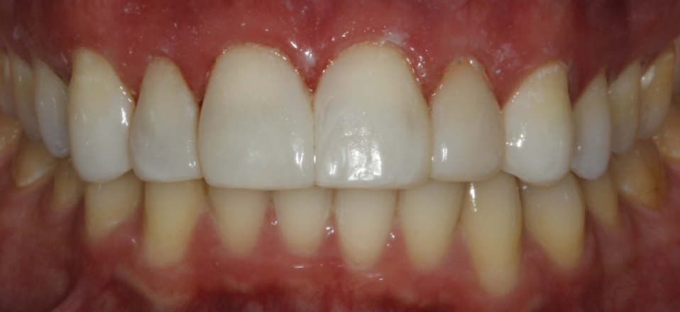 Bioclear