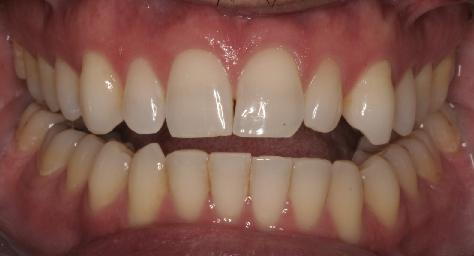 Bioclear