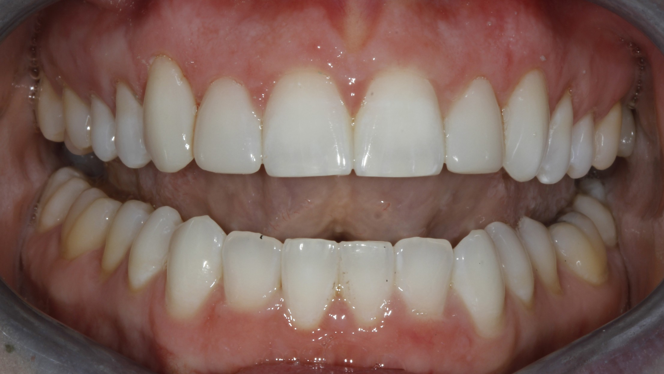 Bioclear