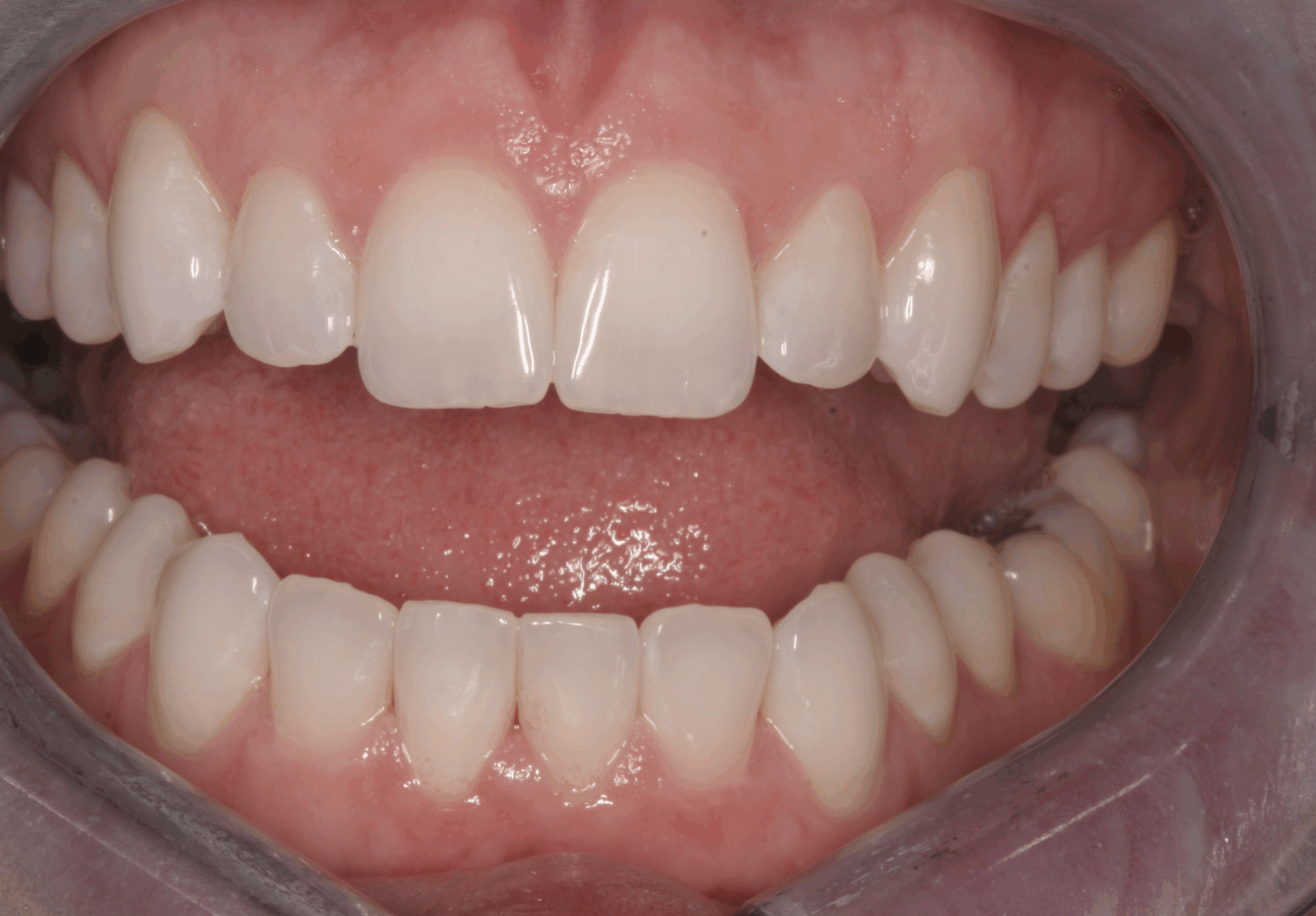 Bioclear