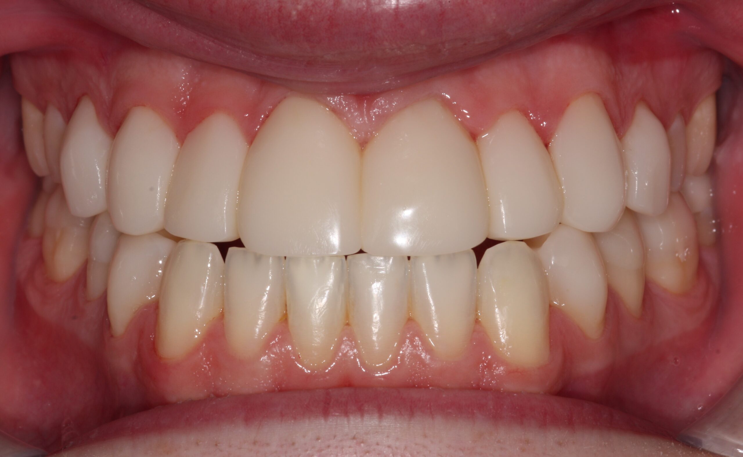Bioclear