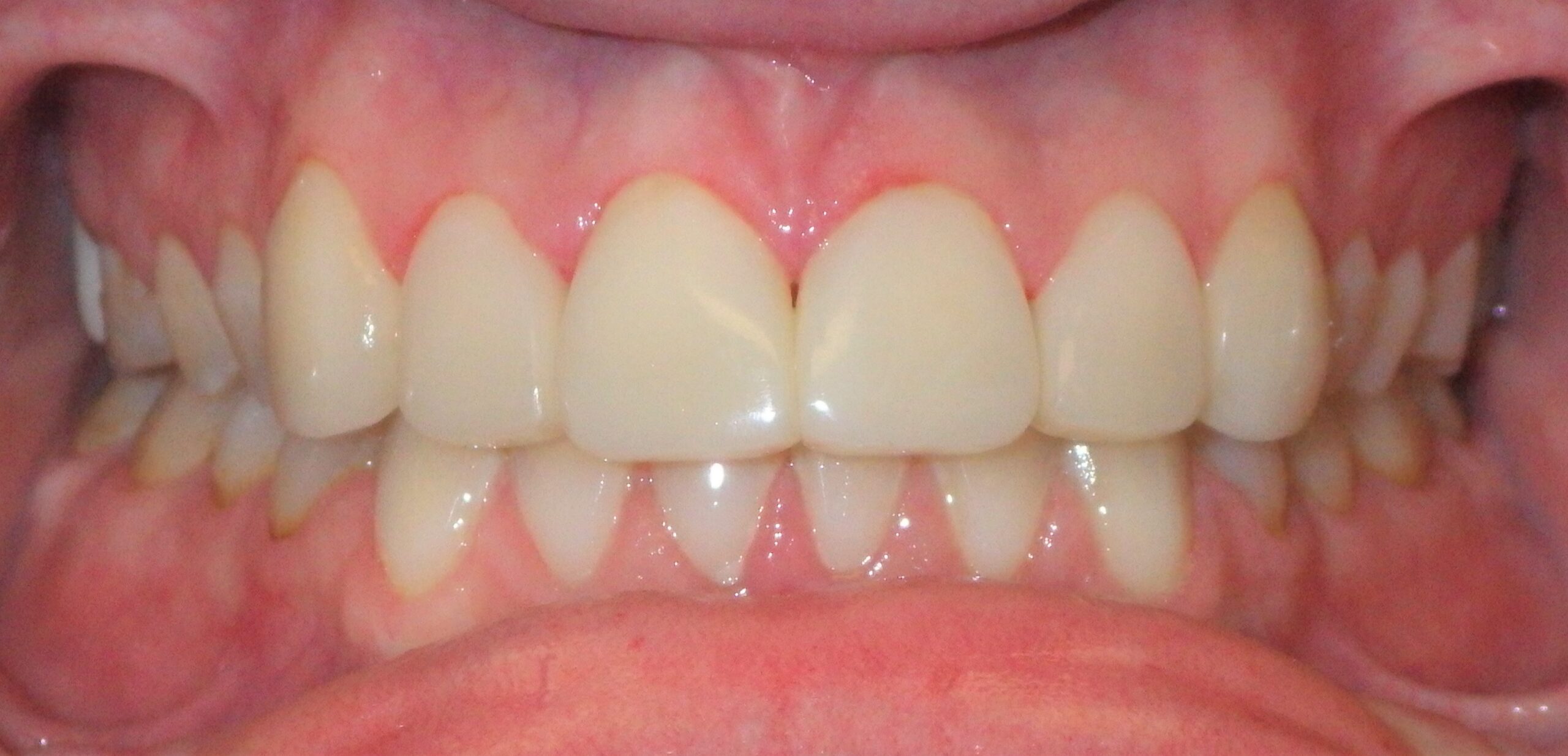 Bioclear