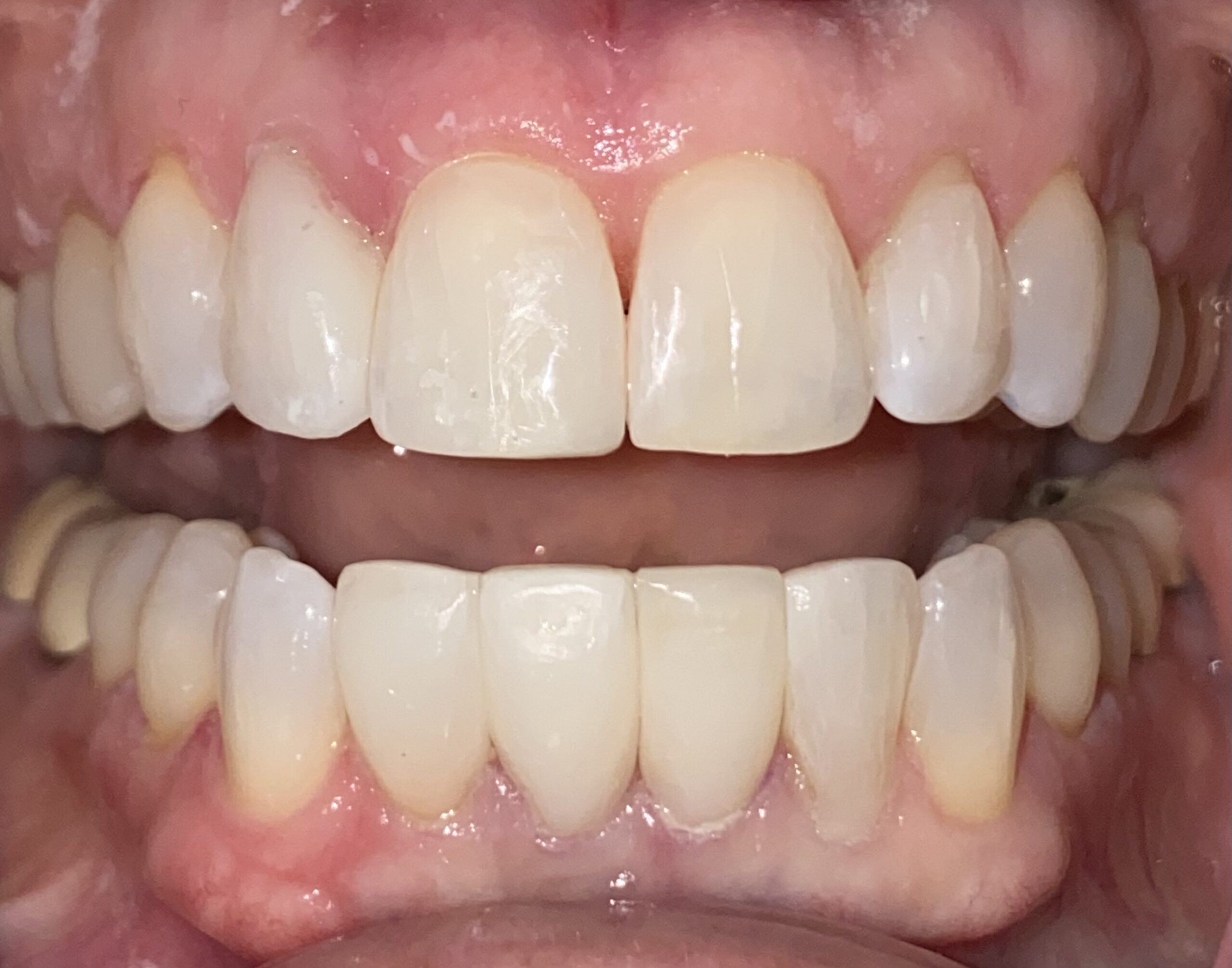 Bioclear