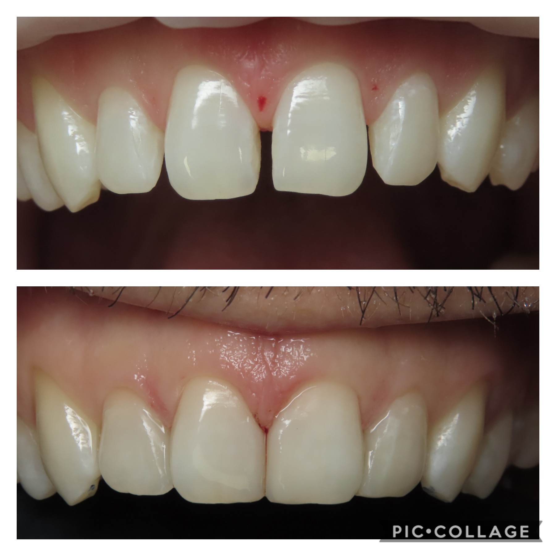 Bioclear