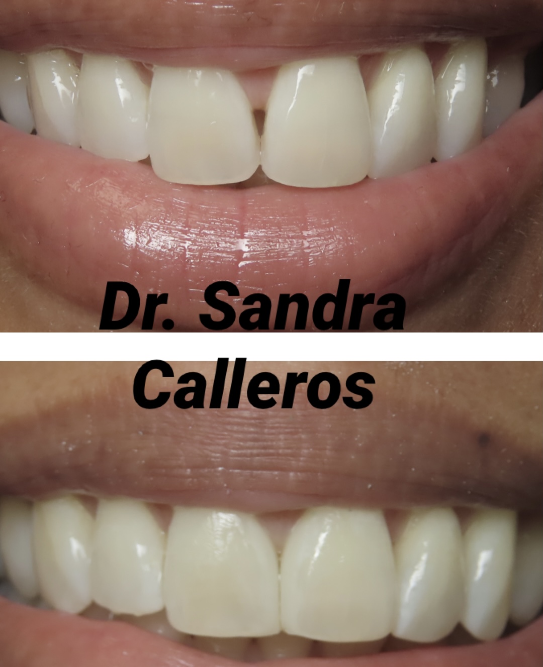 Bioclear