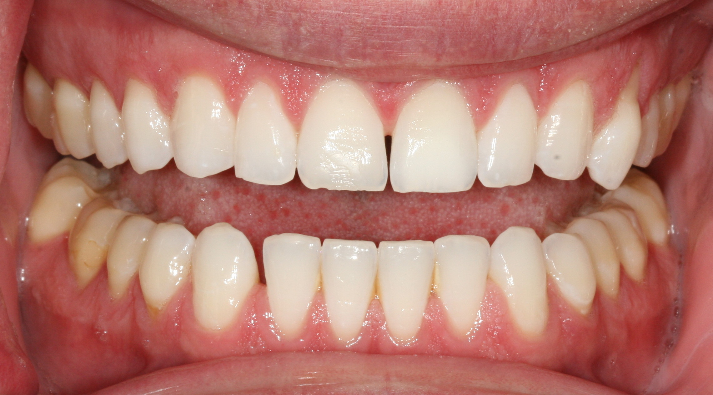 Bioclear
