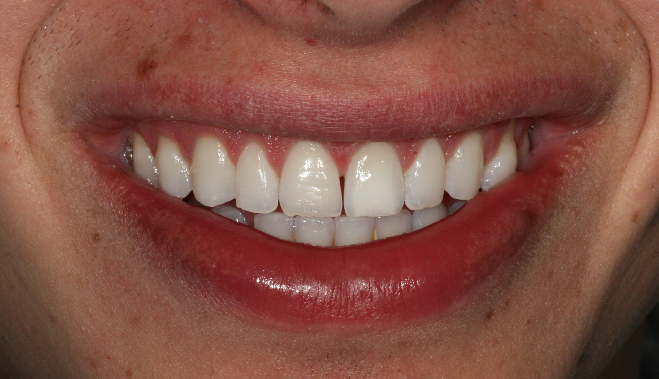 Bioclear