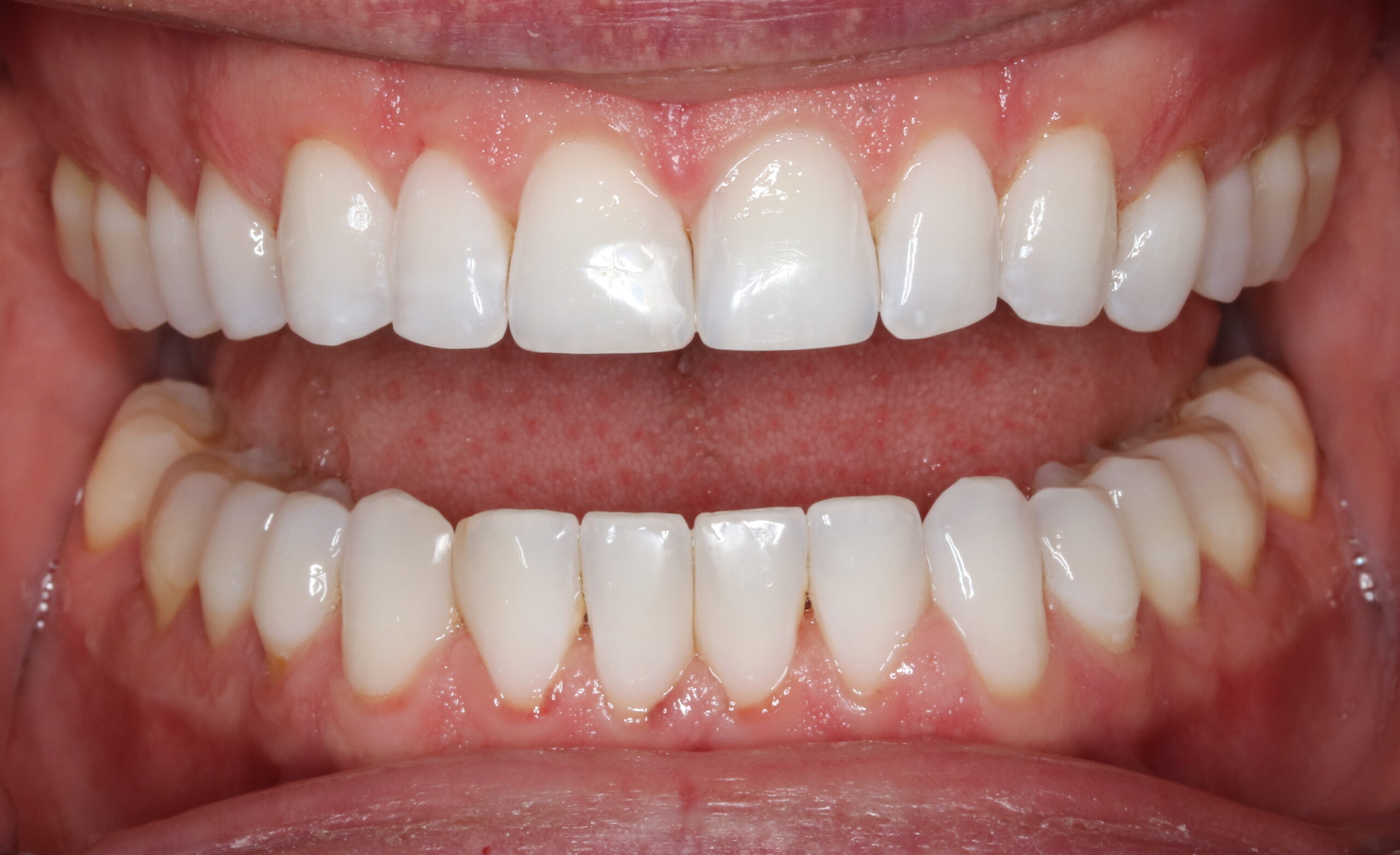 Bioclear