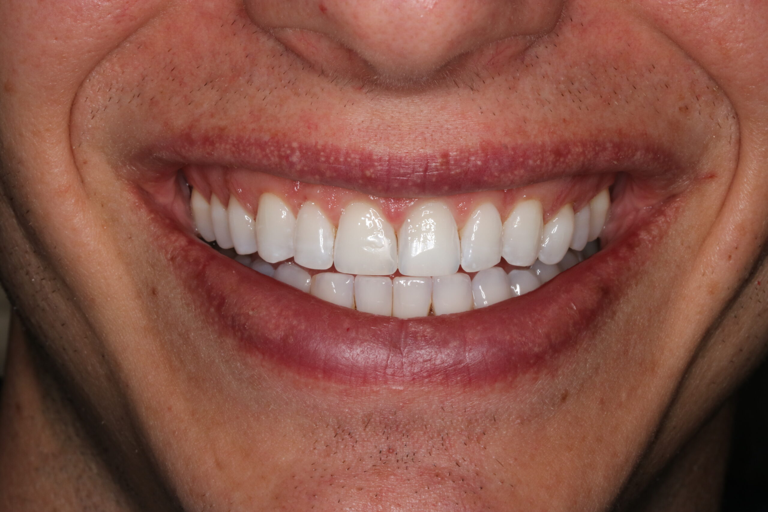 Bioclear