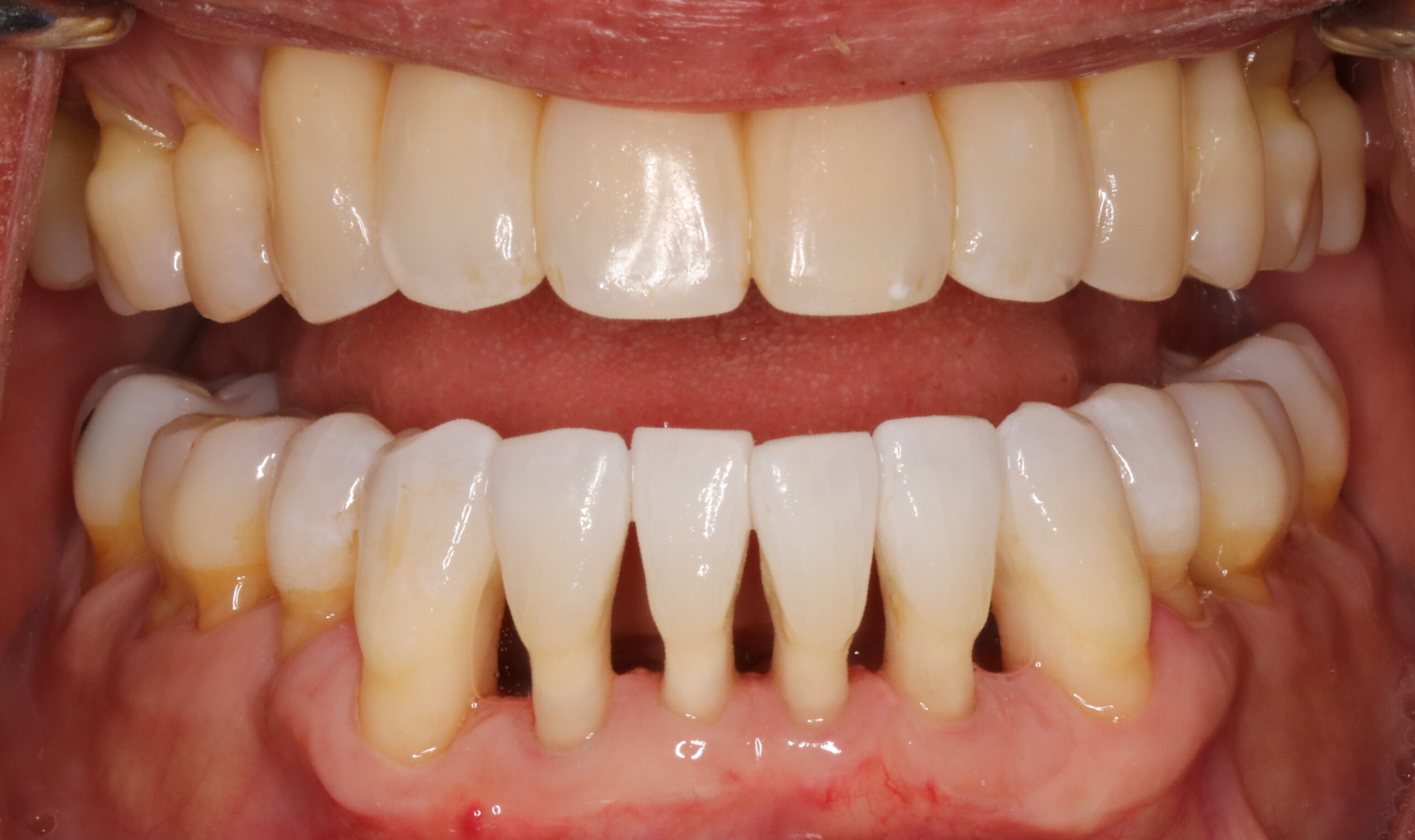 Bioclear