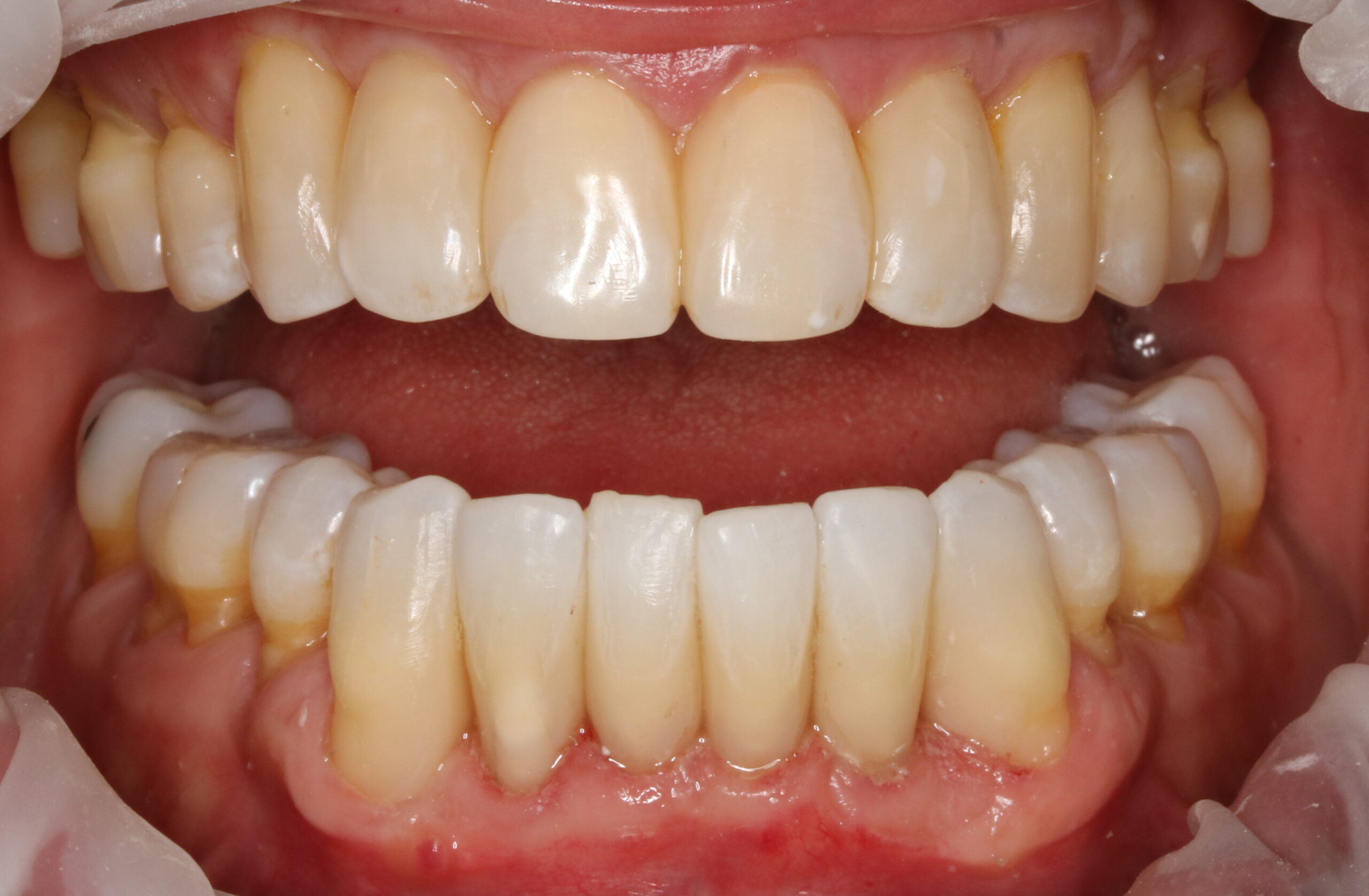 Bioclear