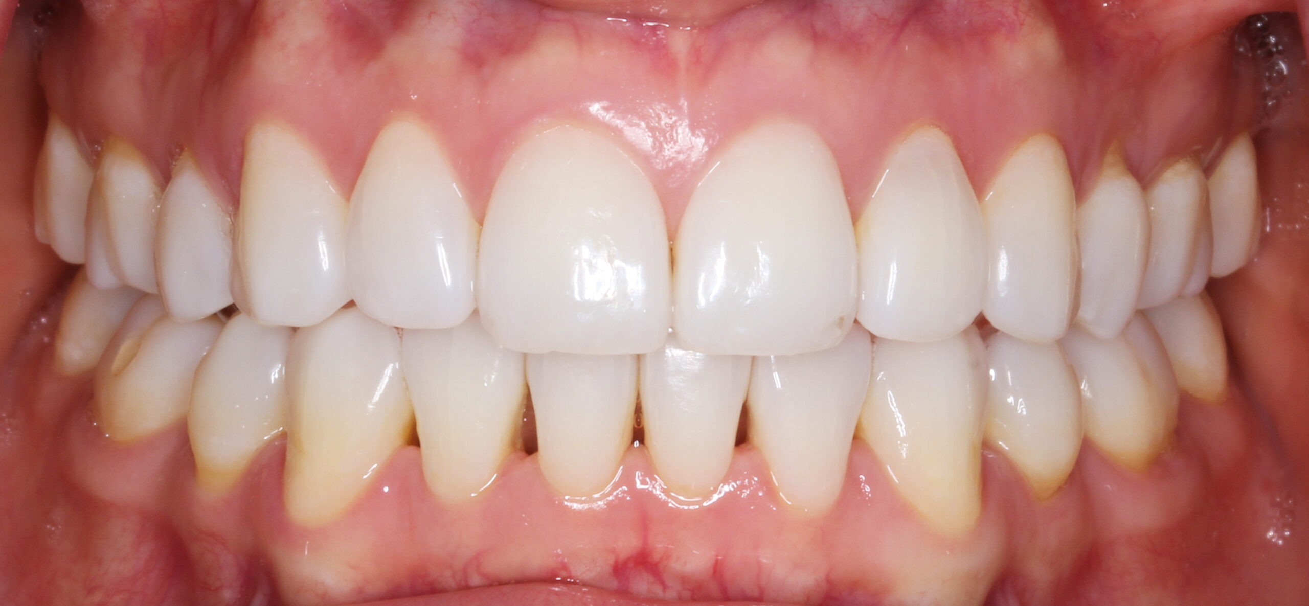 Bioclear