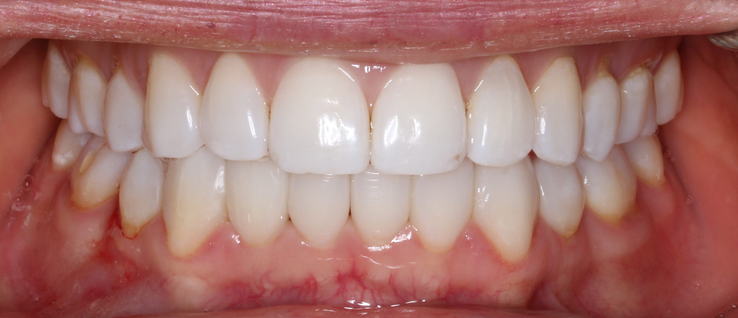 Bioclear