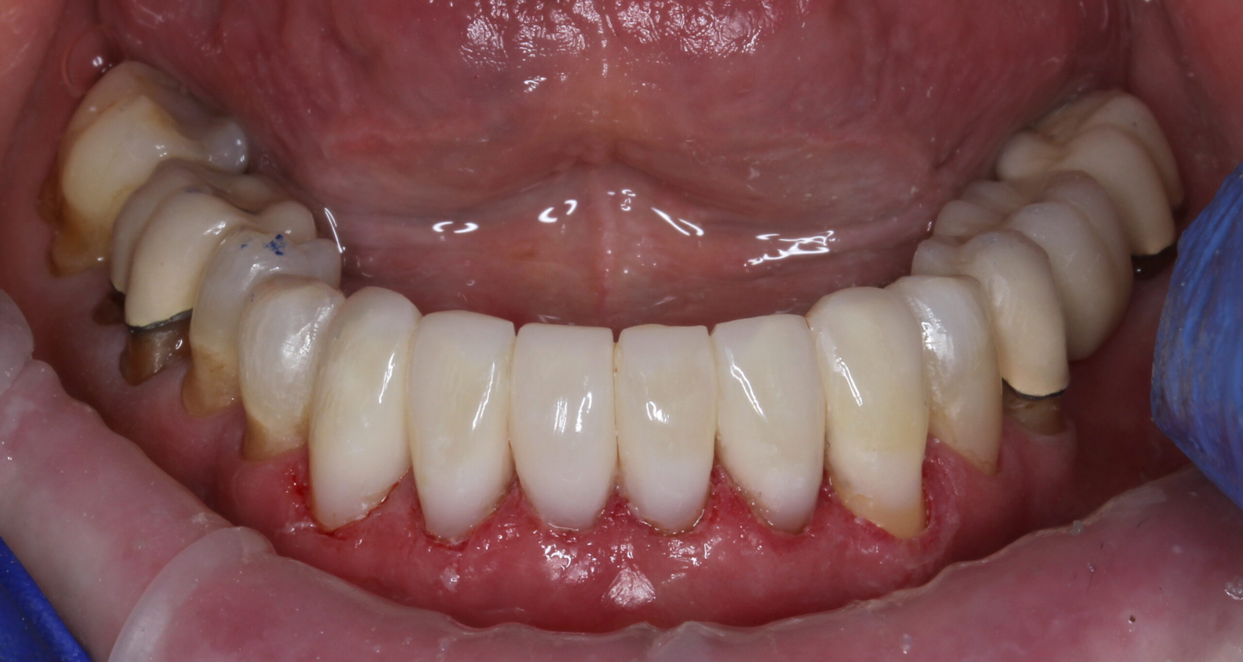 Bioclear