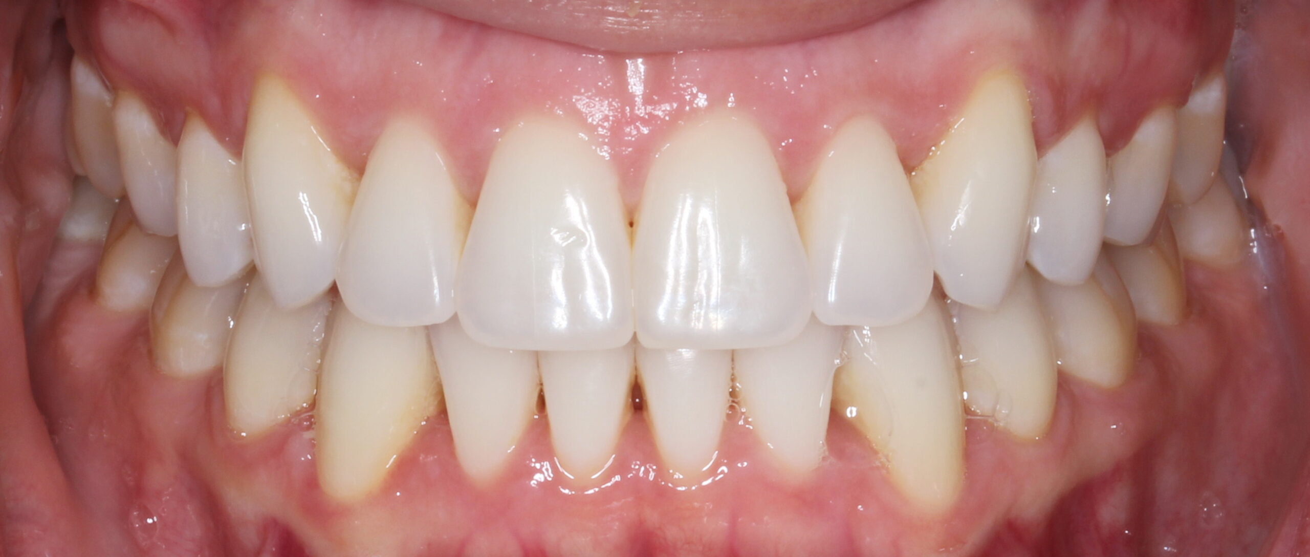 Bioclear