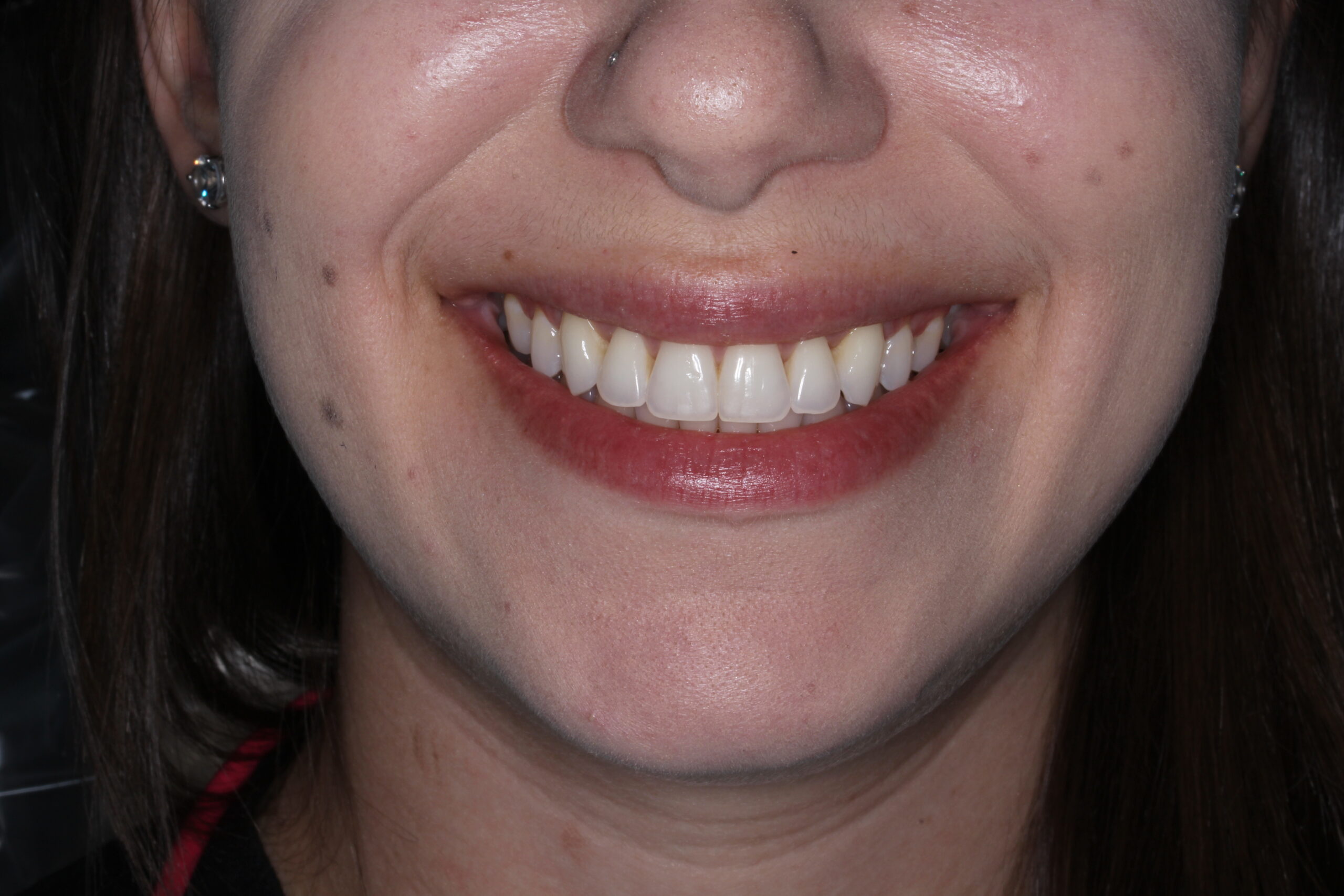 Bioclear