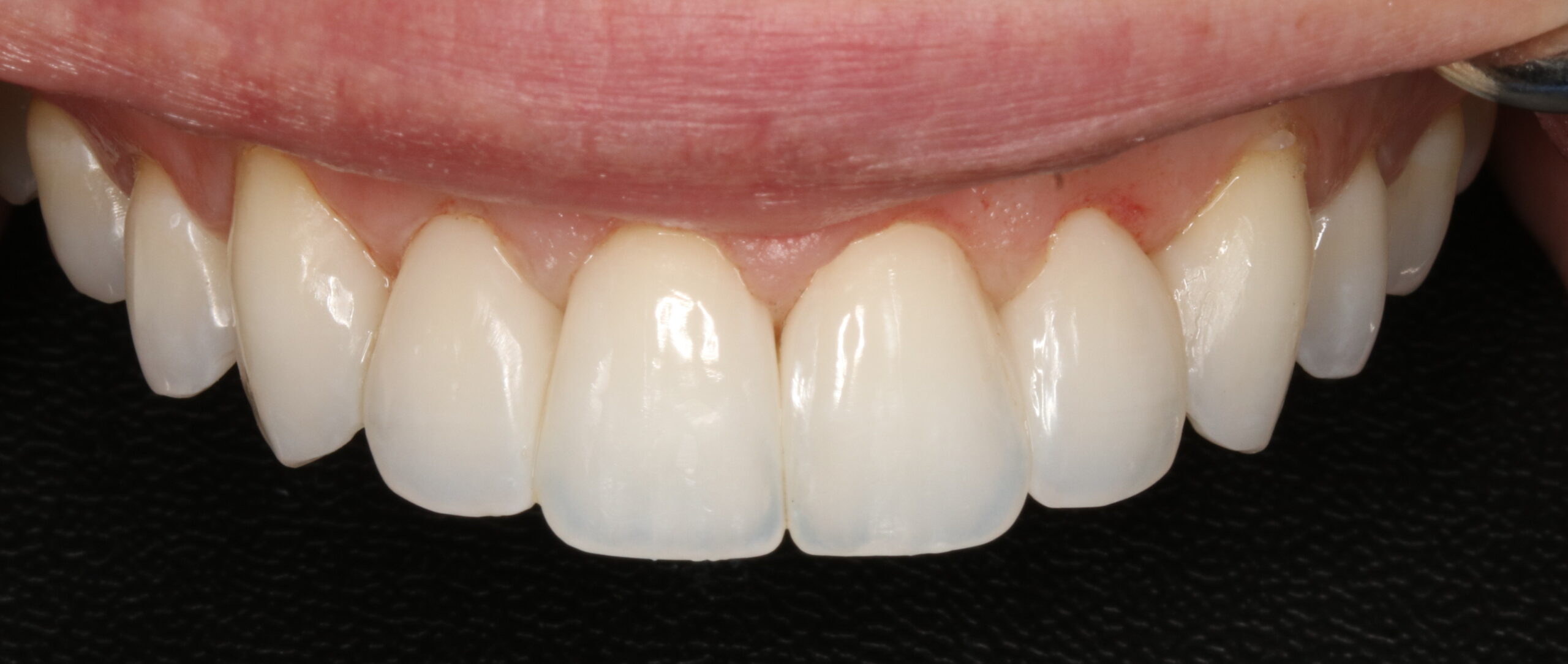 Bioclear