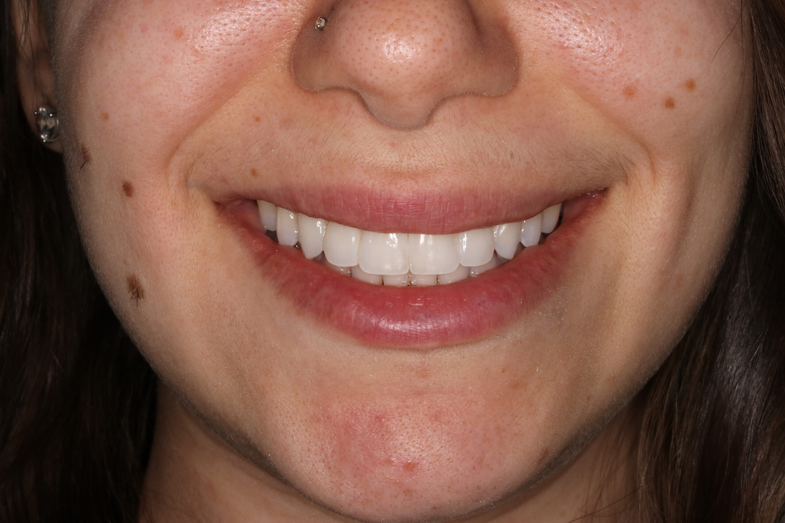 Bioclear