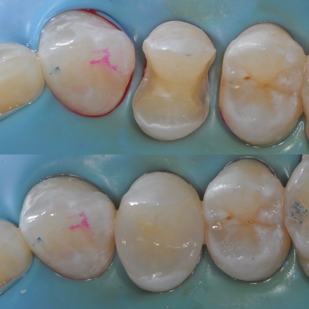 Bioclear