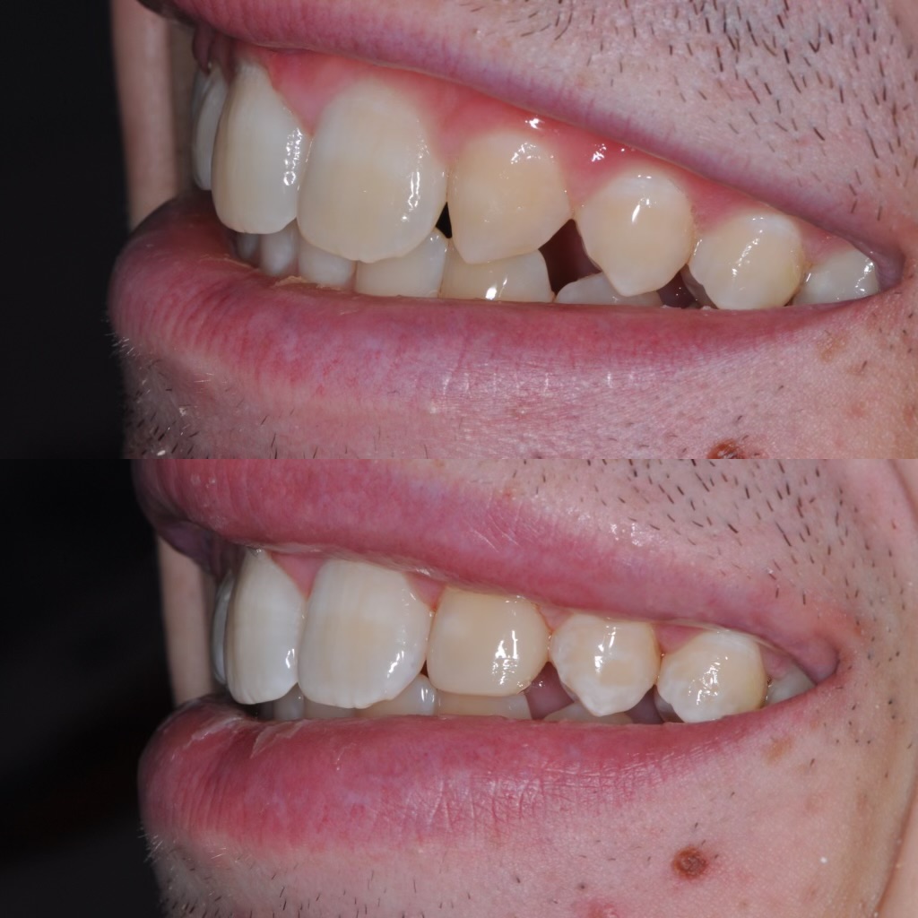 Bioclear
