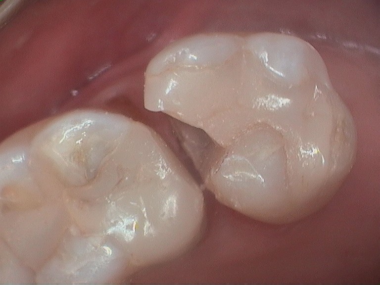 Bioclear