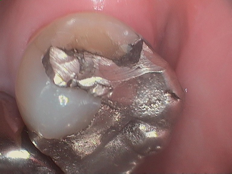 Bioclear