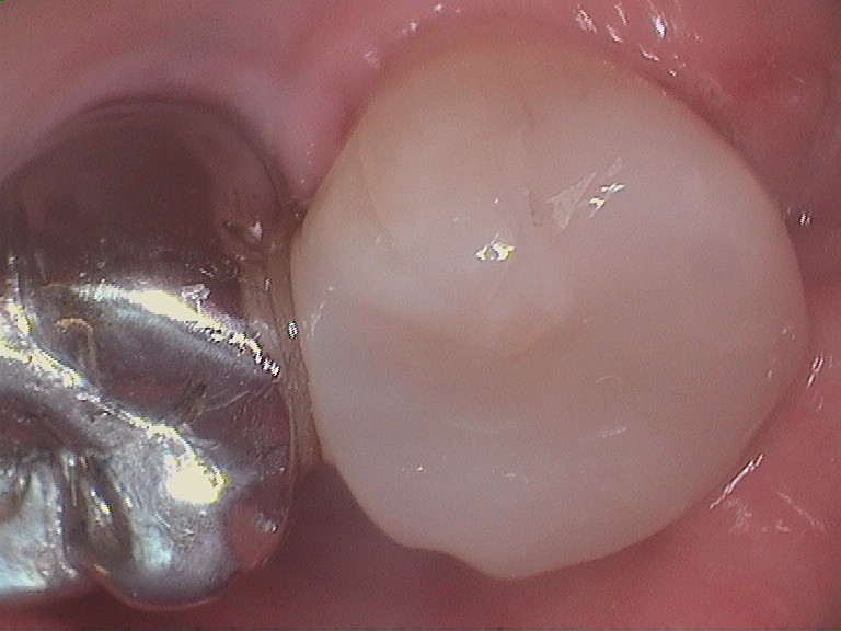 Bioclear