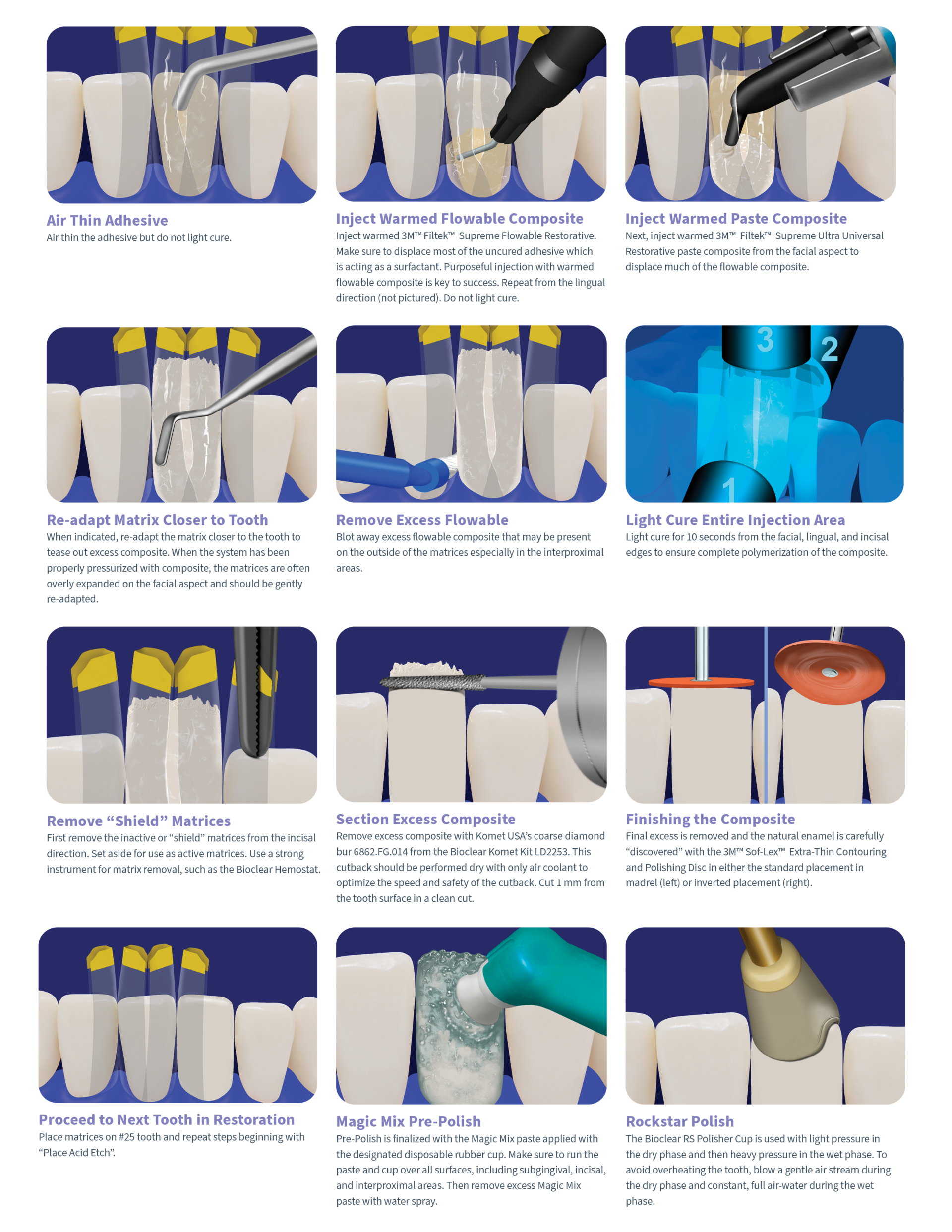 Illustrated Black Triangle Procedural Guide - Bioclear Illustrated Black Triangle Procedural Guide - Bioclear