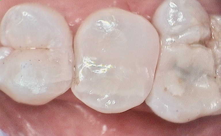 Bioclear