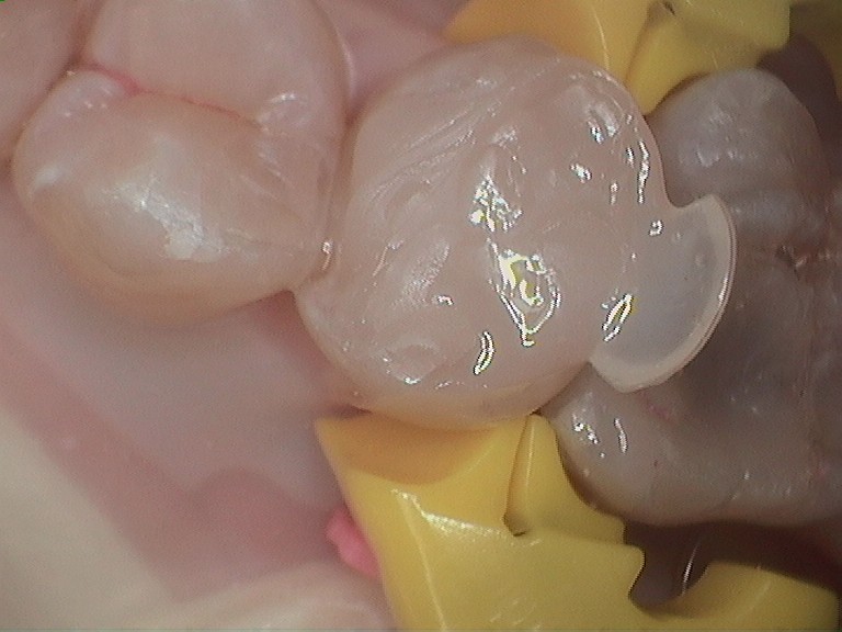 Bioclear