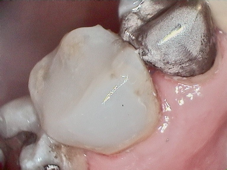 Bioclear
