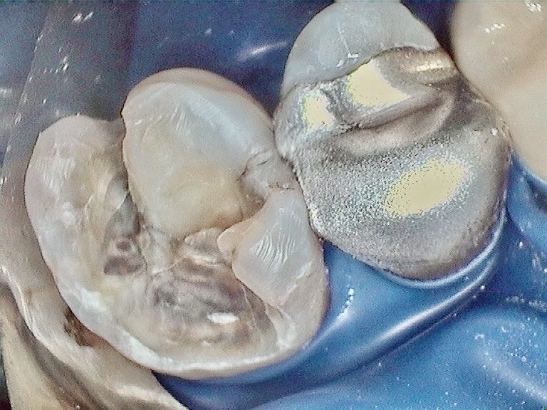 Bioclear