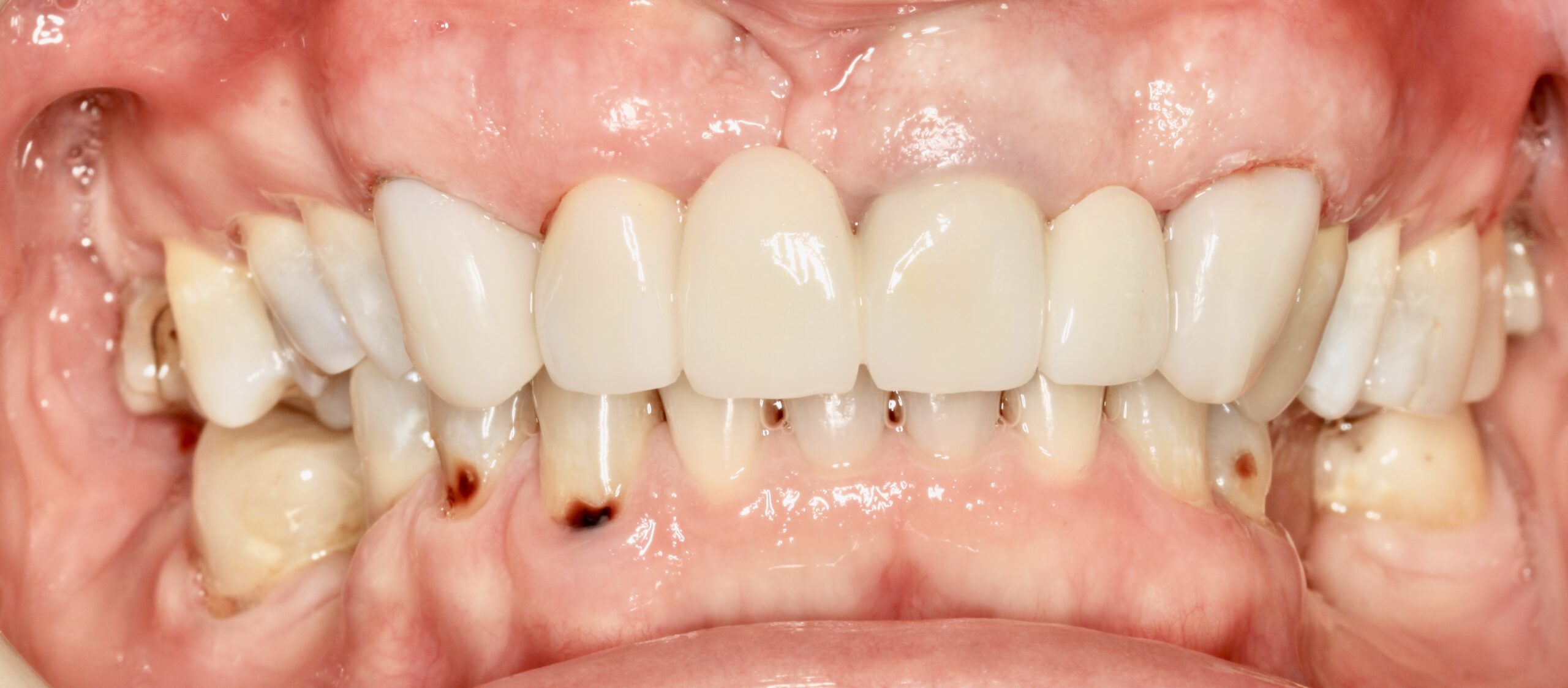 Bioclear