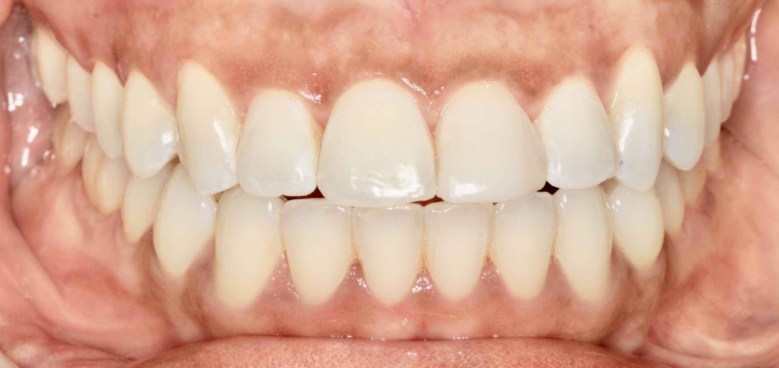 Bioclear